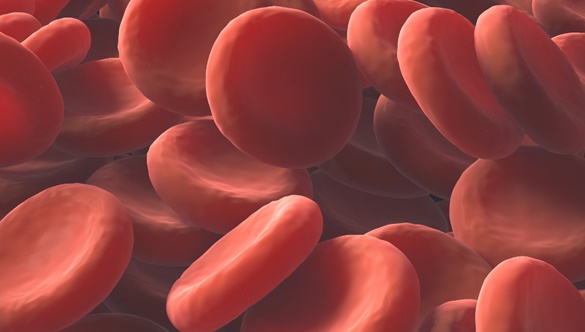 Co to jest anemia i czy dotyczy tylko osób z problemami odżywiania